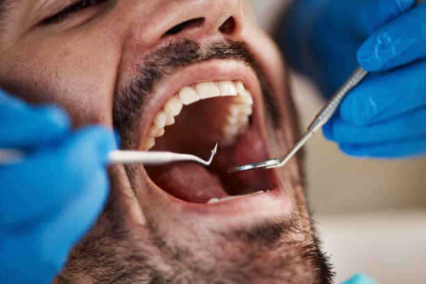 Best Emergency Dental Care  in Graham, TX